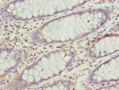 ACADM Antibody