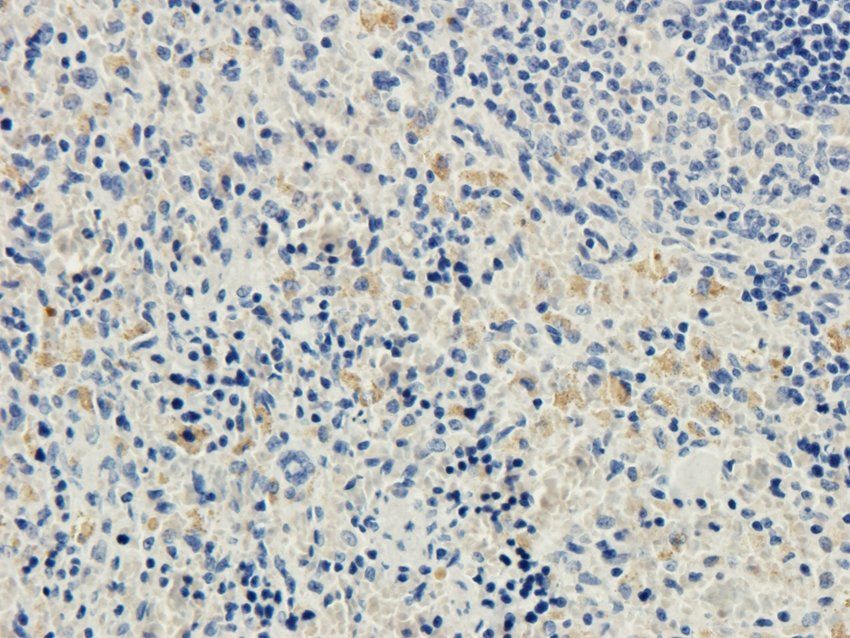 ACAT2 Rabbit Polyclonal Antibody