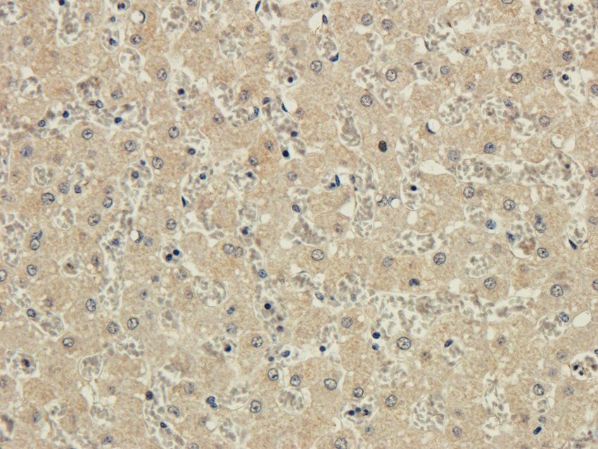 ACAT2 Rabbit Polyclonal Antibody