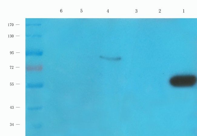 ACAT2 Rabbit Polyclonal Antibody