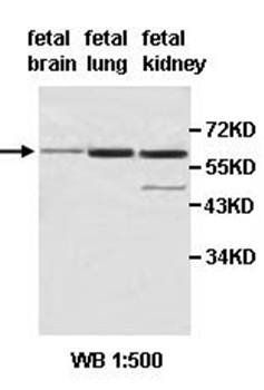 ACD Rabbit Polyclonal Antibody