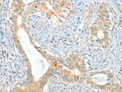 ACE Antibody