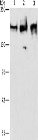 ACE Antibody