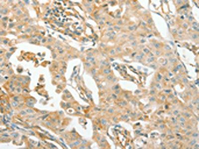 ACE Antibody