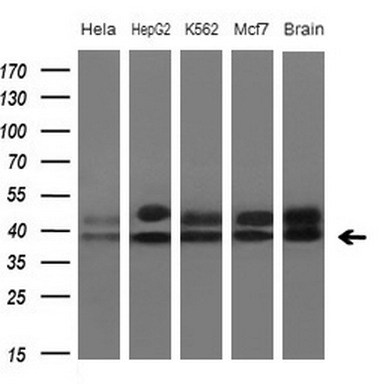 ACE2 Antibody