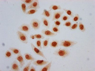 HIST1H2AG Antibody
