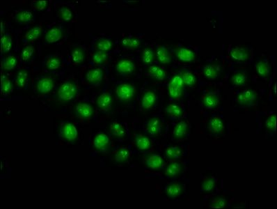 HIST1H2AG Antibody
