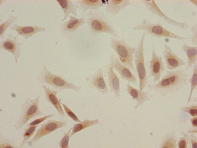 HIST1H3A Antibody