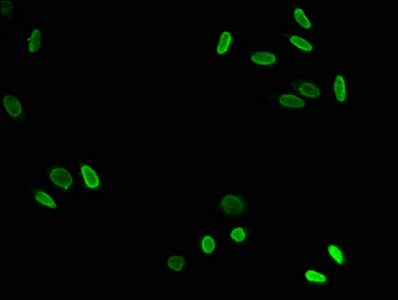 HIST1H3A Antibody