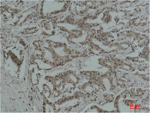 Acetyl Lysine Antibody