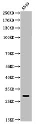 ATF5 Antibody