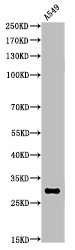 ATF5 Antibody