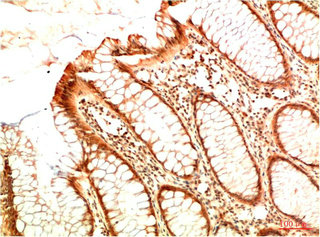 Acetyl-TP53(K382) Antibody