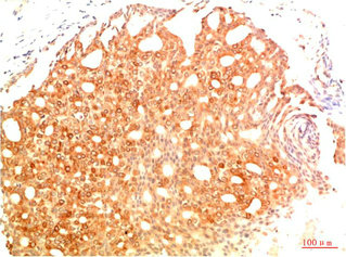 Acetyl-TP53(K382) Antibody