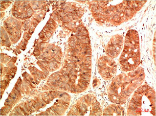 Acetyl-TP53(K382) Antibody