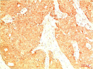 Acetyl-TP53(K382) Antibody