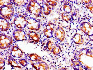 ACO1 Antibody