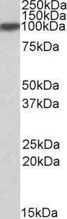 ACO1/Aconitase 1 Antibody