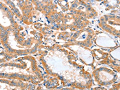 ACOT11 Antibody