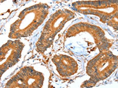 ACOT11 Antibody