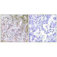 ACOT12 Antibody