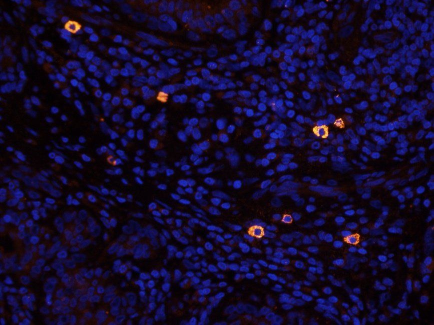 Acrosin Rabbit Polyclonal Antibody