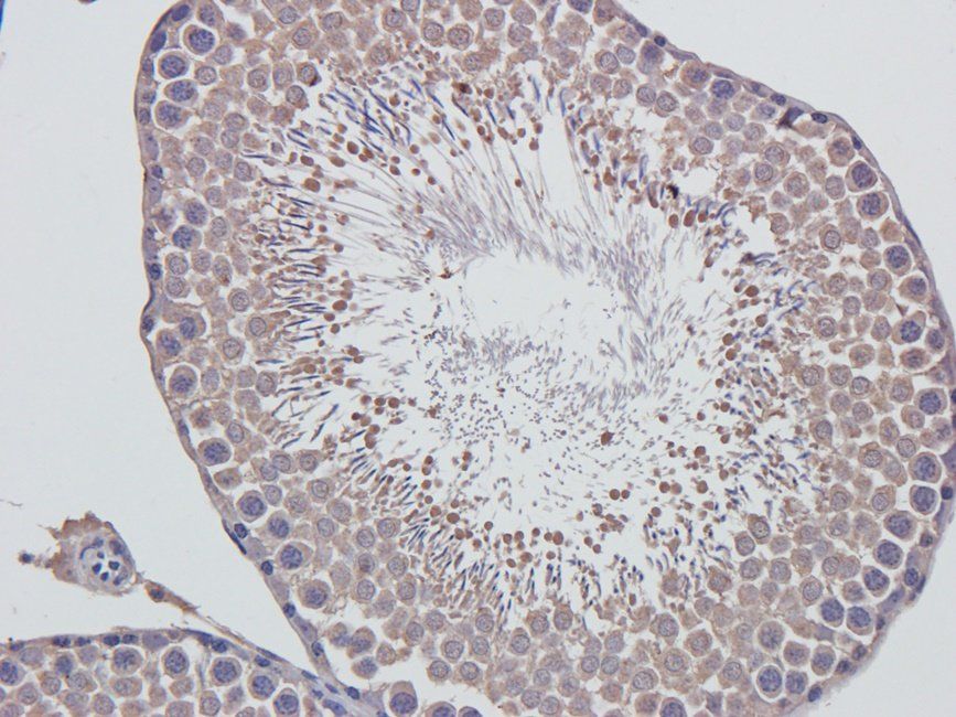 Acrosin Rabbit Polyclonal Antibody