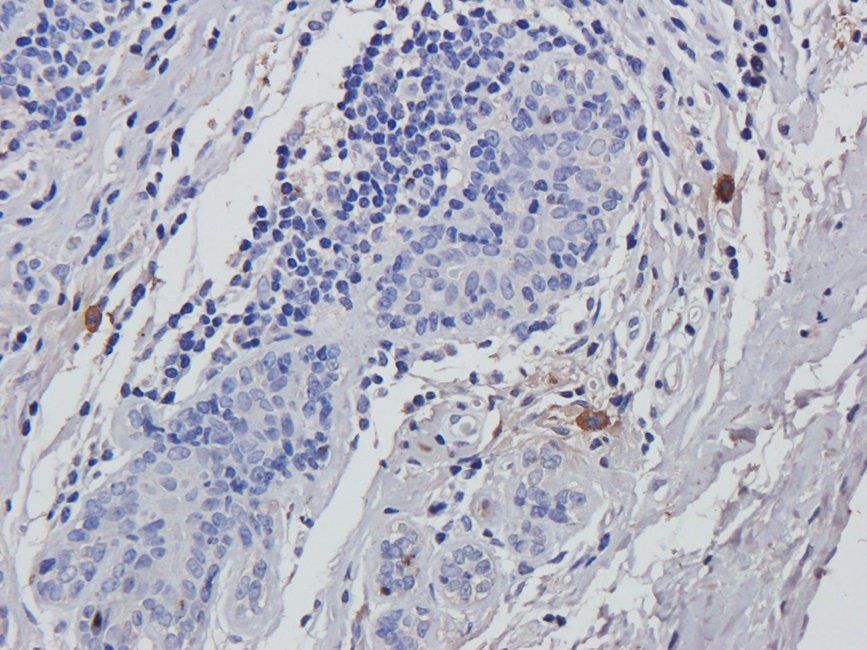 Acrosin Rabbit Polyclonal Antibody