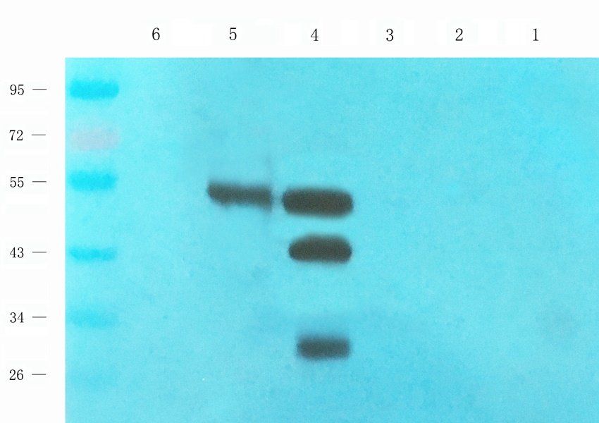 Acrosin Rabbit Polyclonal Antibody