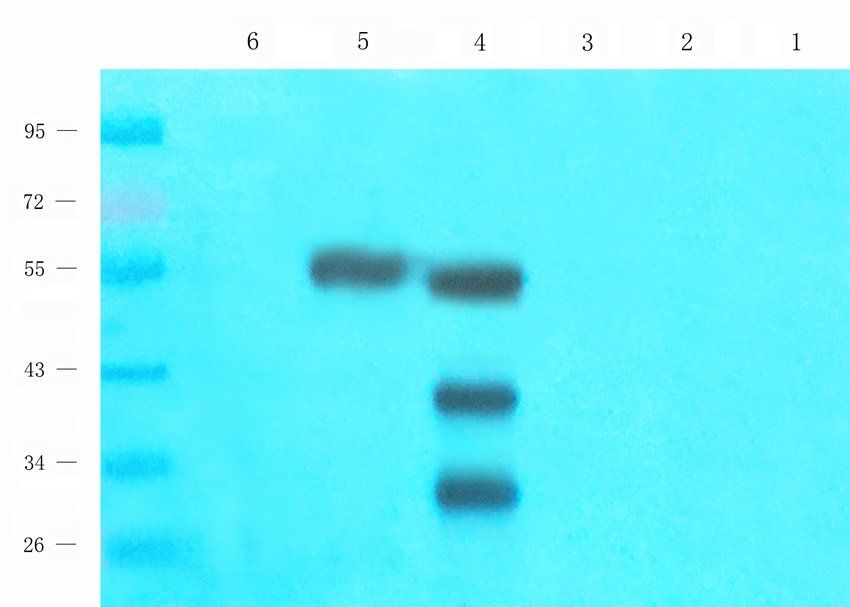 Acrosin Rabbit Polyclonal Antibody