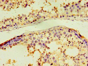 ACRV1 Antibody