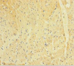 ACTA1 Antibody