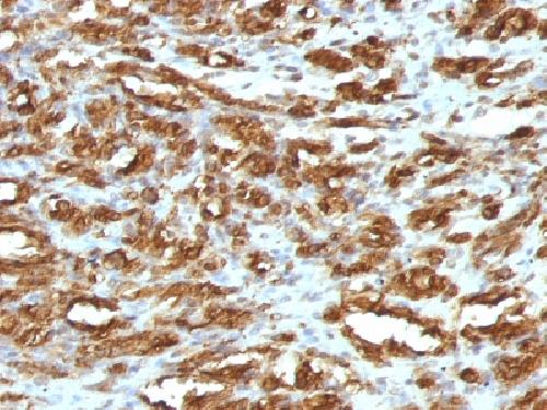 ACTA2 Antibody