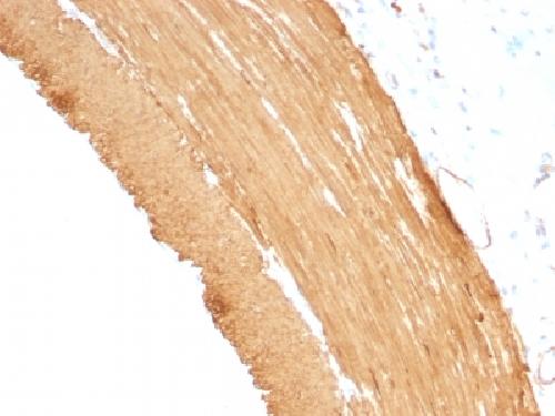 ACTA2 Antibody