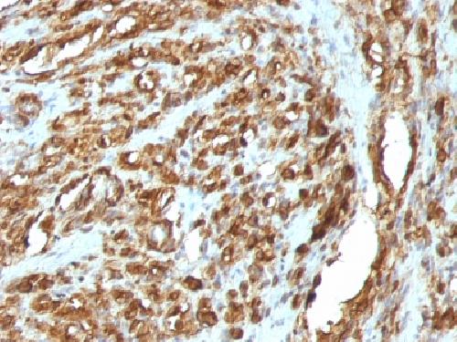 ACTA2 Antibody