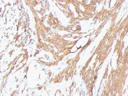 ACTA2 Antibody