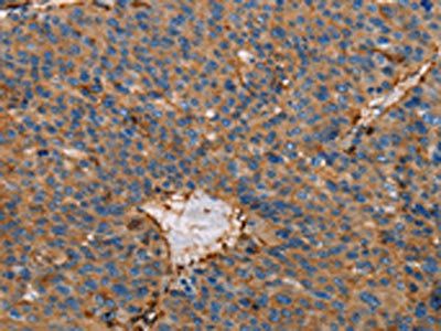 ACTA1 Antibody