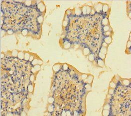 ACTA2 Antibody