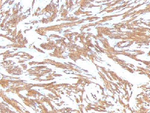 ACTA2 Antibody