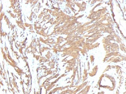 ACTA2 Antibody