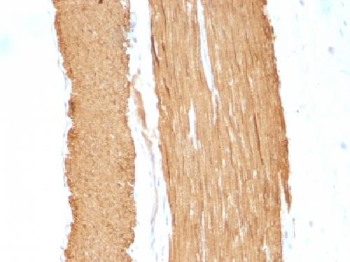 ACTA2 Antibody