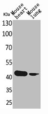 ACTC1 Antibody
