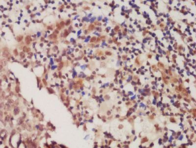 ACTG2 Rabbit Polyclonal Antibody
