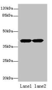 ACTRT2 Antibody