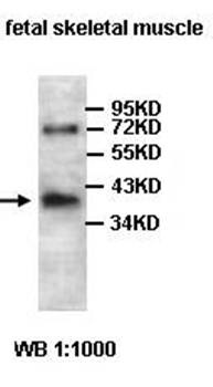 ACTRT2 Rabbit Polyclonal Antibody