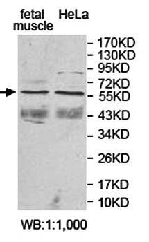 ACVR2A Rabbit Polyclonal Antibody