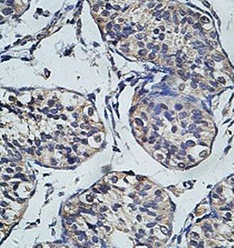 ACVR2A Rabbit Polyclonal Antibody