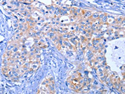 ACVR2B Antibody