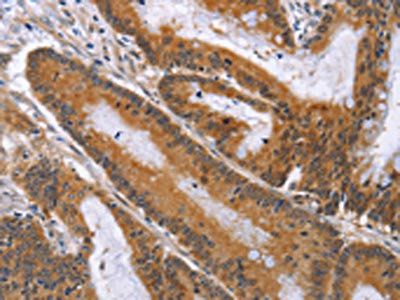 ACVR2B Antibody