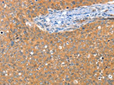 ACY3 Antibody